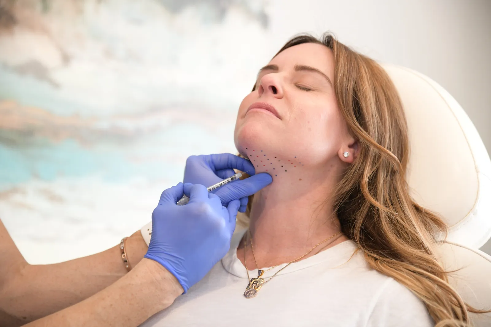 Kybella
