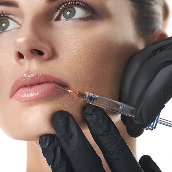 Lip filler